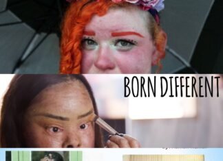 5 types of rare diseases that you never heard before!.. Rare disease