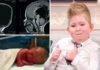 Without brain can a child live? After 6 years the report surprised everyone.. Brain