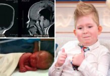 Without brain can a child live? After 6 years the report surprised everyone.. Brain