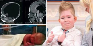 Without brain can a child live? After 6 years the report surprised everyone.. Brain