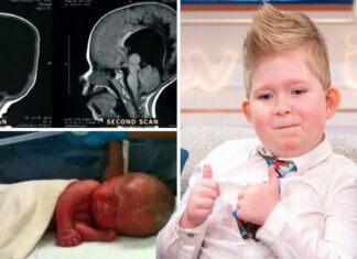 Without brain can a child live? After 6 years the report surprised everyone.. Brain