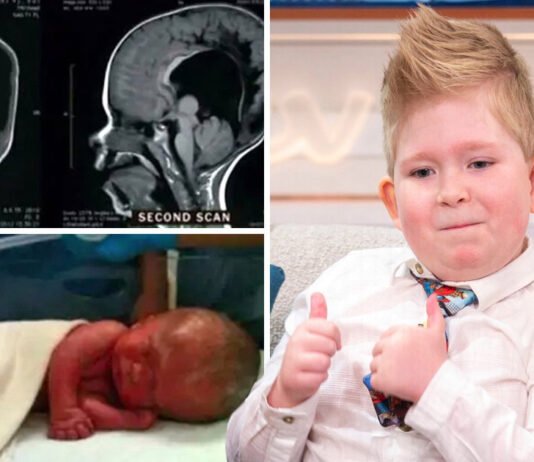 Without brain can a child live? After 6 years the report surprised everyone.. Brain