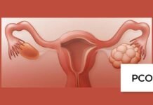 Suffering from PCOD? Then read this 5 question answered by gynocologist about PCOD! Suffering from PCOD? Then read this 5 question answered by gynocologist about PCOD!