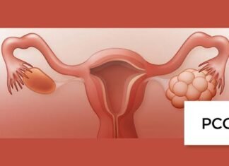 Suffering from PCOD? Then read this 5 question answered by gynocologist about PCOD! Suffering from PCOD? Then read this 5 question answered by gynocologist about PCOD!